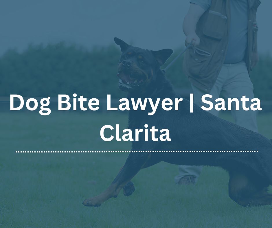 santa clarita dog bite lawyer